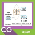 CCO - Lesions Measurement (2).webp