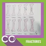 Fractures.webp