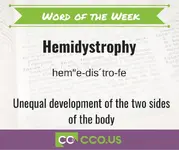 Word of the Week Hemidystrophy 4 7.webp
