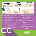 CCO MOHS.webp