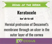 _Word of the Week Keratocele 3 6 23.webp