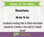 _Word of the Week Hematoma 8 7 23.webp