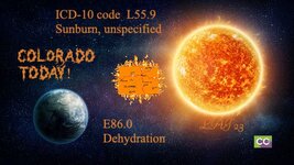 aapc sunburn ICD CCO 1.jpg